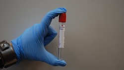 Жители Углегорска и Шахтерска могут сделать экспресс-тест на ВИЧ 